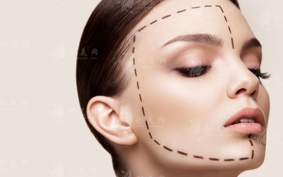 顴骨內(nèi)推后遺癥解析：術(shù)后擁有精致小V臉的代價(jià)