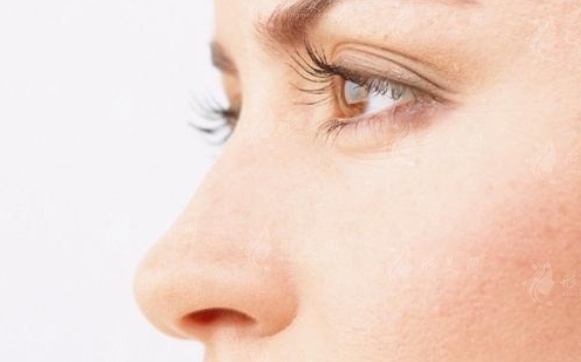 隆鼻后假體取出，鼻子會變形嗎？