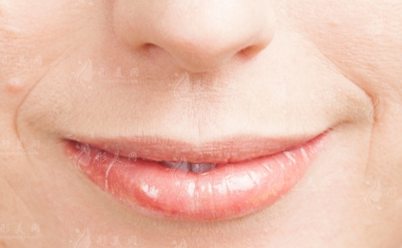 嘴角皺紋怎么去除|嘴角紋除去方式盤點(diǎn)~