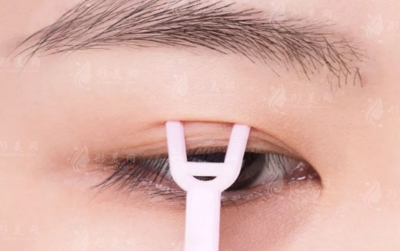 割雙眼皮出現(xiàn)“香腸眼”怎么辦？如何避免？