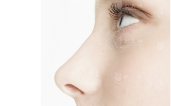 肥厚鼻尖矯正術安全性高嗎？
