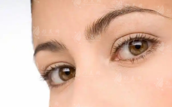 內(nèi)眥贅皮雙眼皮手術(shù)價格及影響因素