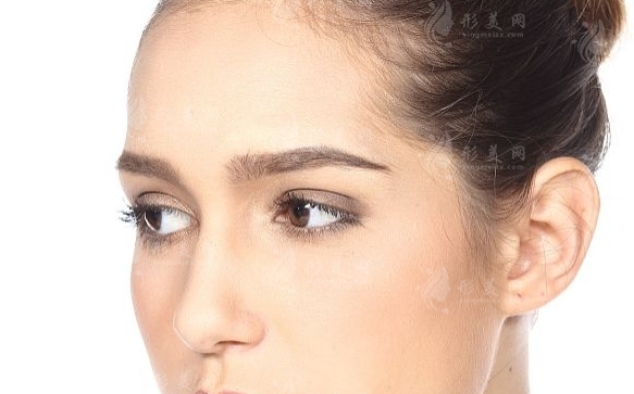 額頭凹陷填充玻尿酸：效果與副作用分析