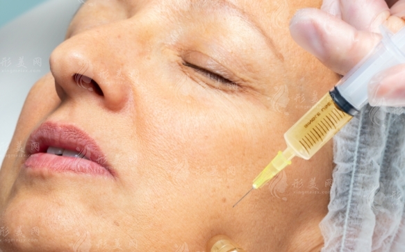 電波拉皮去皺術(shù):重塑臉部肌膚的年輕魅力 電波拉皮去皺術(shù):重塑臉部肌膚的年輕魅力