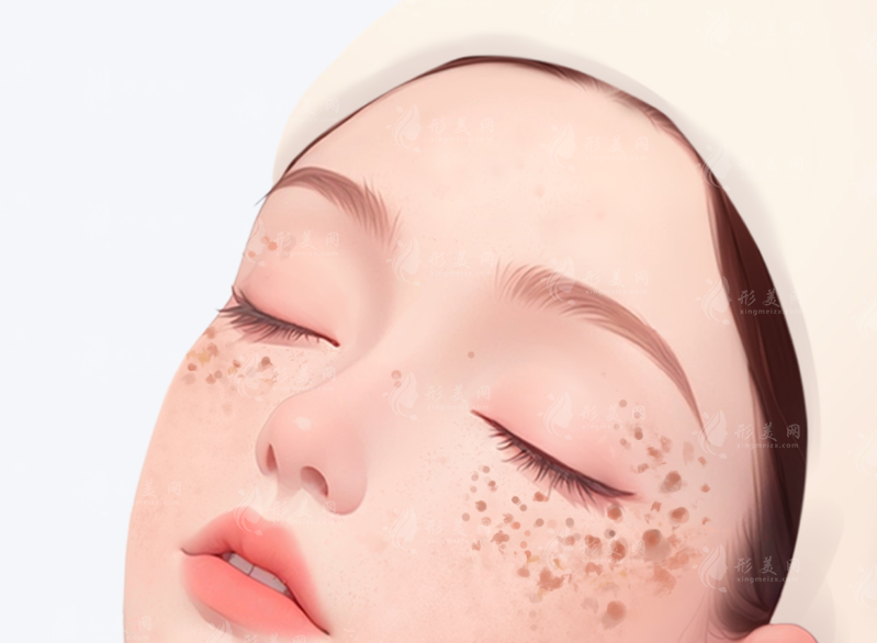 2026激光祛斑價(jià)格揭秘：幾百到上萬差別在哪