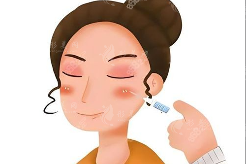 玻尿酸溶解酶多少錢一針？2026價格表+避坑指南