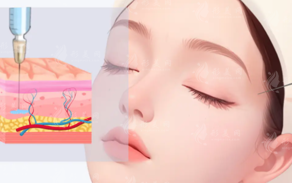 喬雅登豐顏vs塑顏：區(qū)別在哪怎么選?一看就懂!