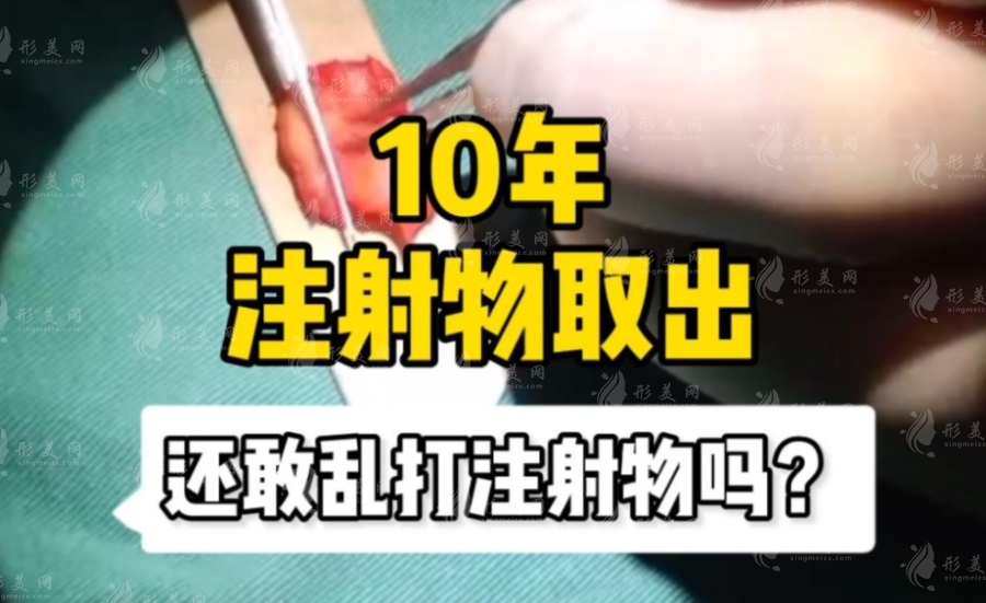 北京注射物取出醫(yī)生推薦：郭鑫醫(yī)生技術(shù)好口碑佳