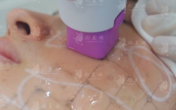 熱瑪吉5代vs4代怎么選?6大區(qū)別避坑指南