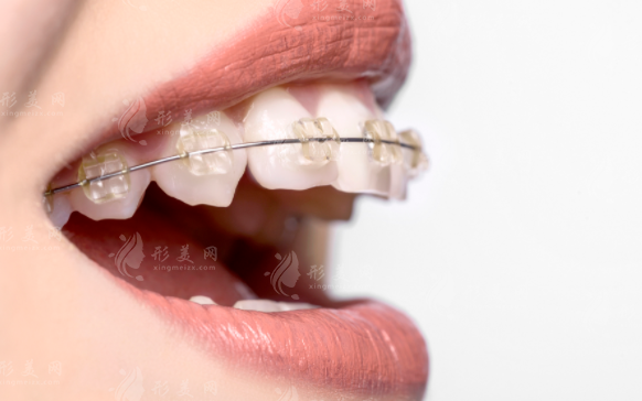 北京諾美口腔2026收費(fèi)價(jià)目表曝光！6店通用/種植牙4988起/矯正8800起