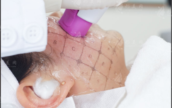 熱瑪吉5代探頭有幾個(gè)?3個(gè)才是正品別被坑