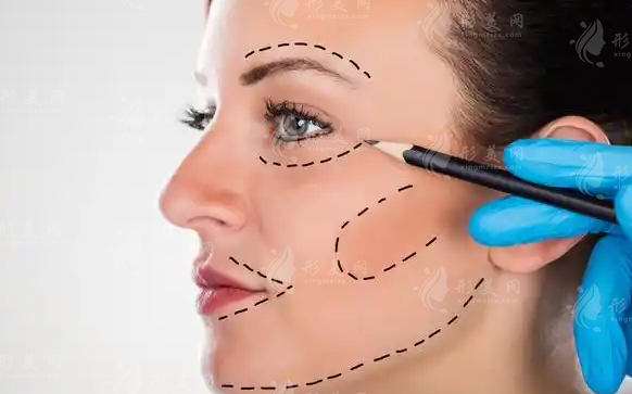 王乙立無痕筋膜提升靠譜嗎?技術(shù)實力+價格全解析!