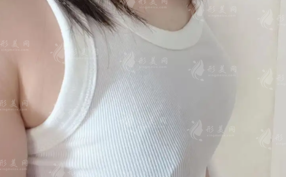 幸蘊(yùn)無痕豐胸靠譜嗎？效果/價格/維持時間全解析