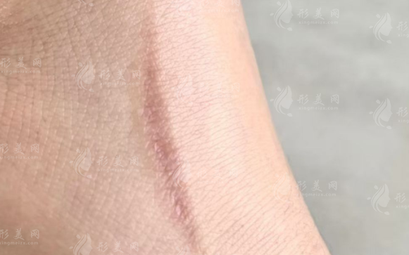 貴陽(yáng)華醫(yī)疤痕科2026價(jià)目表:劉青/劉曉芳/黨永明醫(yī)生收費(fèi)曝光 貴陽(yáng)華醫(yī)疤痕科2026價(jià)目表:劉青/劉曉芳/黨永明醫(yī)生收費(fèi)曝光