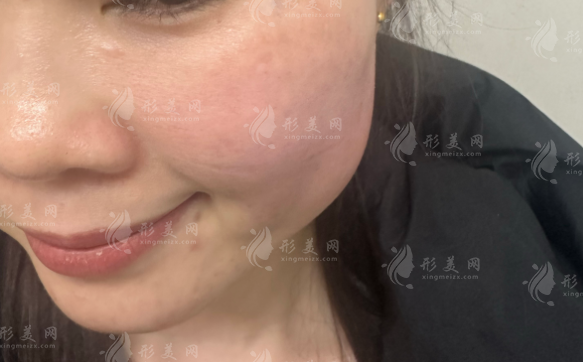 北京黎星醫(yī)生20年專(zhuān)攻修復(fù)，生長(zhǎng)因子取出微創(chuàng)無(wú)痕