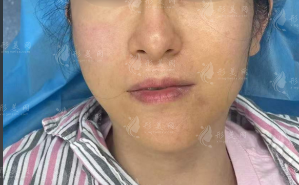 上海王洪醫(yī)生靠譜嗎?生長(zhǎng)因子奧美定修復(fù)技術(shù)全揭秘