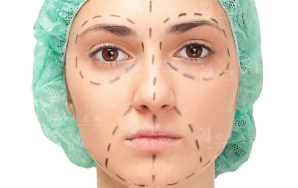 上海星璨李海濤拉皮靠譜嗎?筋膜復(fù)位技術(shù)口碑實(shí)測(cè)