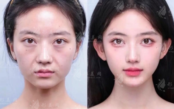 上海幼態(tài)臉醫(yī)生排名2026，郭敬松申濤聶婕技術(shù)解析