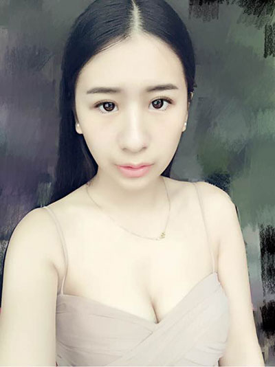 【雙眼皮+豐下巴】對比照 瞬間變女神