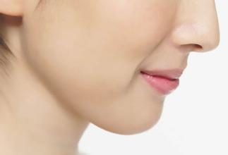 隆下巴優(yōu)勢