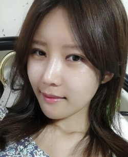 面部多項(xiàng)目整形對(duì)比照 改頭換面成女神