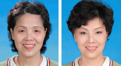 電波拉皮費(fèi)用多少