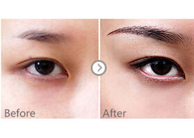 紋眉禁忌癥有哪些