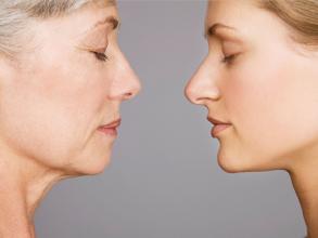 緊膚除皺效果如何