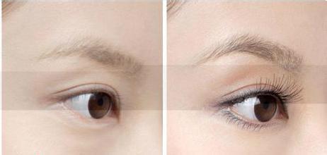 睫毛種植有哪些危害