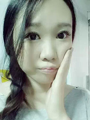 全切雙眼皮 單眼皮變大眼氣質(zhì)美眉