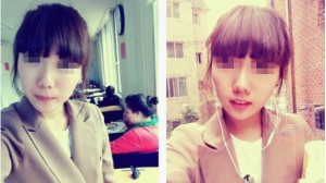 瘦臉針 能給我標(biāo)準(zhǔn)臉型配苗條身材