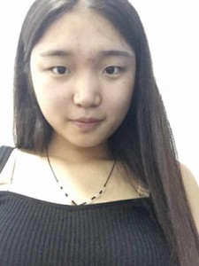 全切雙眼皮 開啟心靈之窗 - 珍美網(wǎng)