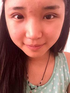 全切雙眼皮 開啟心靈之窗 - 珍美網(wǎng)