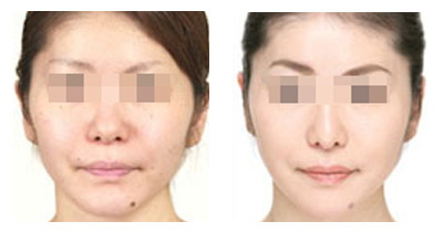 黑臉娃娃有哪些作用