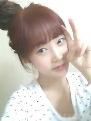 【3D回轉(zhuǎn)顴骨+地包天下巴矯正整形】 打造完美的自己 - 珍美網(wǎng)