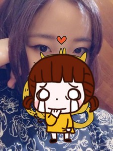 雙眼皮手術+開眼角 讓自己更加女人 - 珍美網(wǎng)