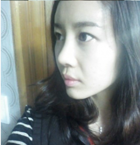 隆鼻手術(shù) 提升美麗翻倍