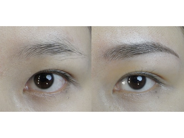 深圳港資天美整形醫(yī)院眉毛種植價格多少錢 - 珍美網(wǎng)