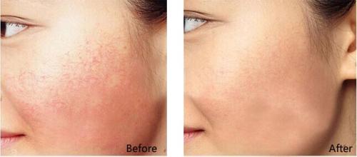 黑臉娃娃價格是多少 - 珍美網(wǎng)