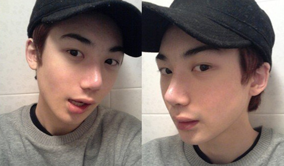 隆鼻手術(shù) 屌絲逆襲成高富帥