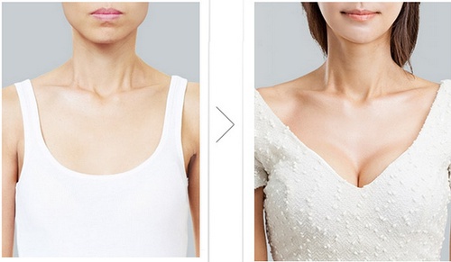 自體脂肪隆胸價格因素有哪些