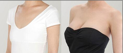 乳房再造術(shù)的優(yōu)點(diǎn)有哪些