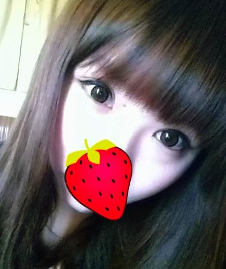 割雙眼皮手術(shù)  我的眼睛更加明亮 - 珍美網(wǎng)