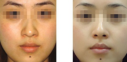 黑臉娃娃維持時(shí)間多久