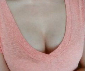 假體隆胸 讓自卑滾得遠遠的