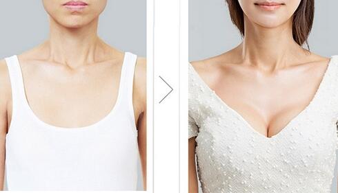 自體脂肪移植豐胸的效果可以保持多久