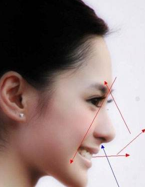 鼻基底填充價格是多少 - 珍美網(wǎng)