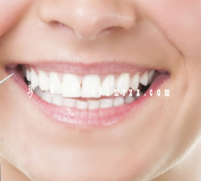 如何延長烤瓷牙的使用壽命呢 - 珍美網(wǎng)