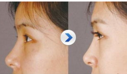 種植睫毛術(shù)維持多久時間 - 珍美網(wǎng)