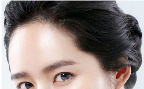 發(fā)際線種植